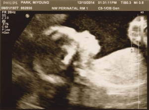 ultrasound 2014-12-10 09.jpg